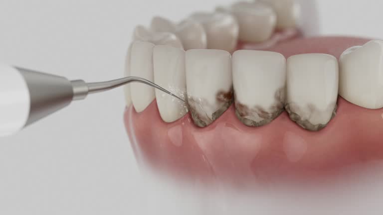 Reliable Dental Implants contractor in Natalbany, LA by Smile Center Dentistry